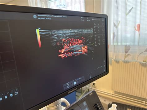 av gar|Ultraljudsundersökning .